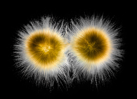 "Gloeotrichia - A cyanobacteria" by Dr. Håkan Kvarnström, Micrographist, Sweden