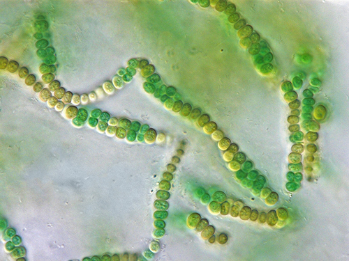 Cyanocohniella crotaloides, Courtesy: Dr. Patrick Jung, Botanist, Scientist, Germany