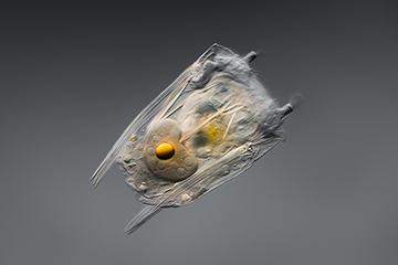 Rotifer by Dr. Håkan Kvarnström, Micrographist, Sweden