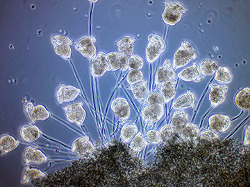 "Ciliates Vorticella" by Andrei Savitsky, Micrographist, Ukraine