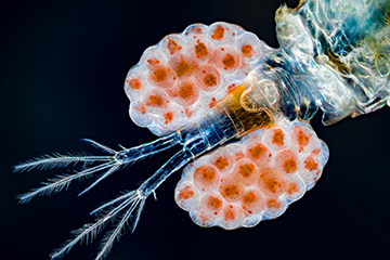 Tail of Copepod carrying eggs by Dr. Håkan Kvarnström, Micrographist, Sweden