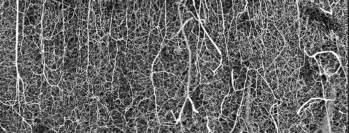 3D vasculature of an adult mouse brain (somatosensory cortex) by Dr. Andrea Tedeschi, Assistant Professor at the Ohio State University, Wexner Medical Center. USA