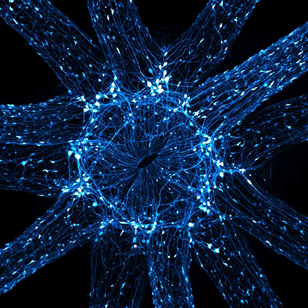 An in vivo snapshot of the neurons surrounding the mouth and tentacles of a juvenile starlet sea anemone (Nematostella vectensis) , Courtesy: Ruohan Zhong, biology, scientist, researcher, USA