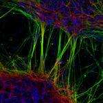 Neuronal-Cells by Dr. Jianqun Gao, neurologist, neuroscientist, China, Australia