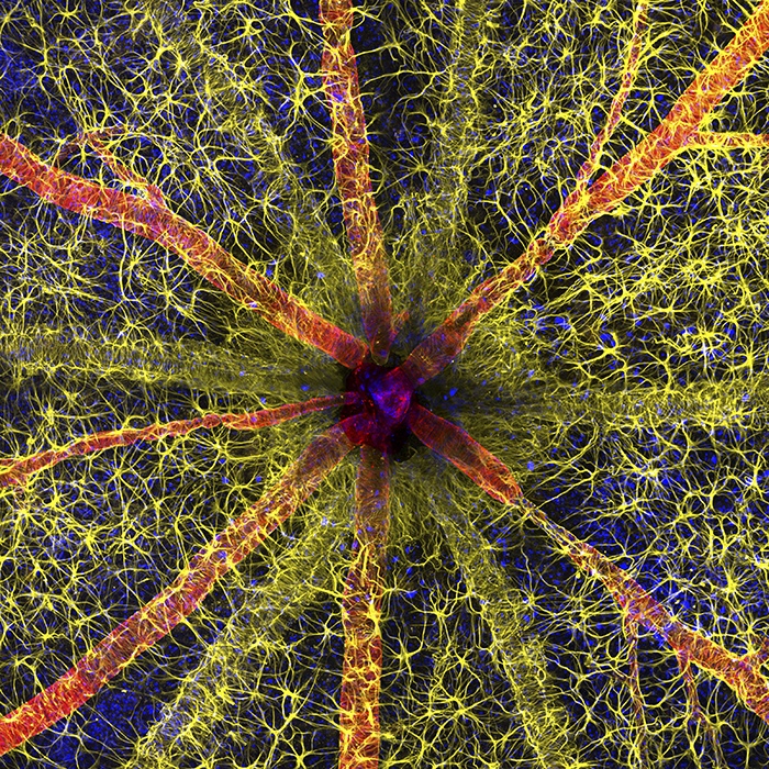 Rodent optic nerve head showing astrocytes (yellow), contractile proteins (red) and retinal vasculature (green) by Hassanain Qambari, Biologist, Scientist, Australia