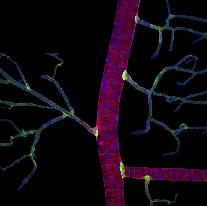 Densely packed contractile proteins and nuclei of a major retinal artery and its arterioles by Hassanain Qambari, Biologist, Scientist, Australia