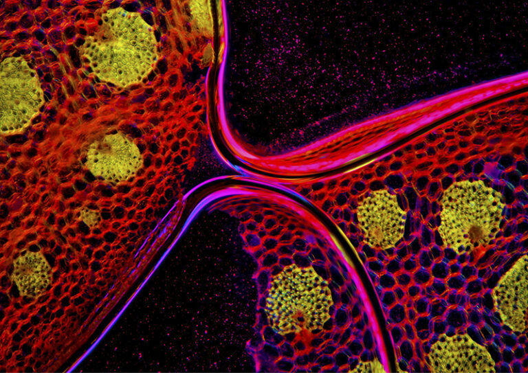 Shape of color, Pink Galaxy, Plant tissue by Malgorzata Lisowska, Health Care, Microscopy, Photographer, Portland