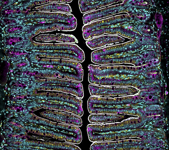 Microscopic View of Intestinal Villi, Honorable Mention, 2024 Nikon Small World Competition by Dr. Amy Engevik, Biologist, GI Tract Researcher, USA