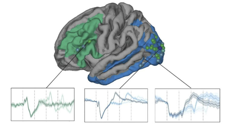 This supplementary figure displays the Linear Mixed Model (LMM) results for Event-Related Potential (ERP) signals in the task-irrelevant condition. Electrodes consistent with the theoretical models are visualized on the brain surface, with prefrontal regions of interest shown in green and posterior regions in blue.