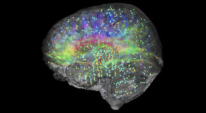 Allen Institute's Informatics team created this image