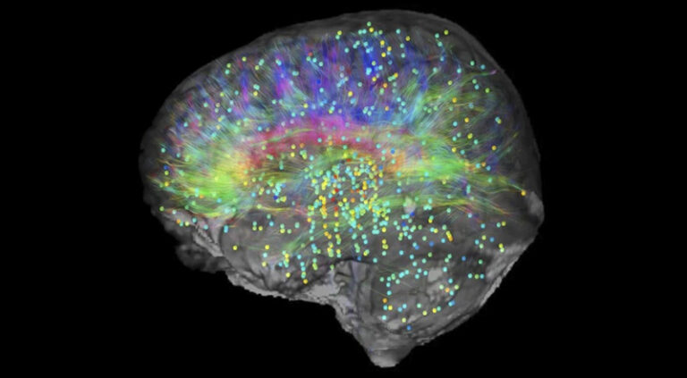 Allen Institute's Informatics team created this image